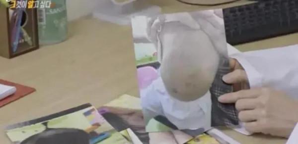 小女孩出生才16個月，被父母虐待致死，韓國虐童致死案