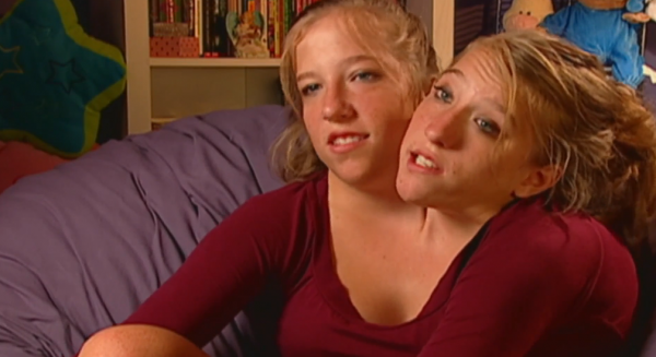 一個身體兩個頭，性格不同的連體姐妹花，該如何生活？