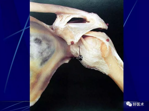 86張全身關節應用解剖精講，這篇文章值得收藏