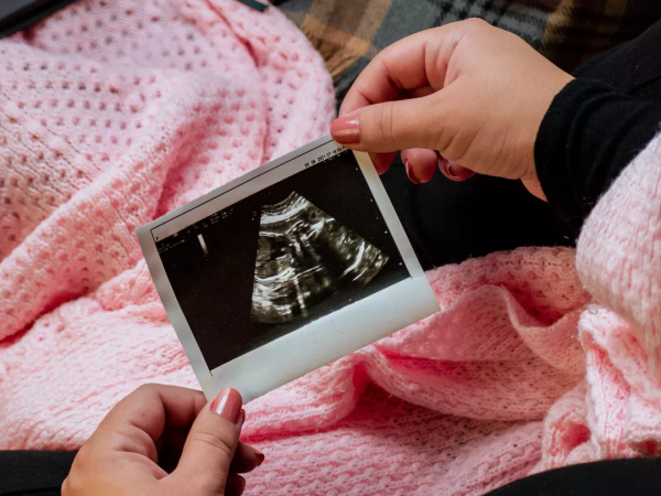 孕檢最全注意事項，為愛的人收藏