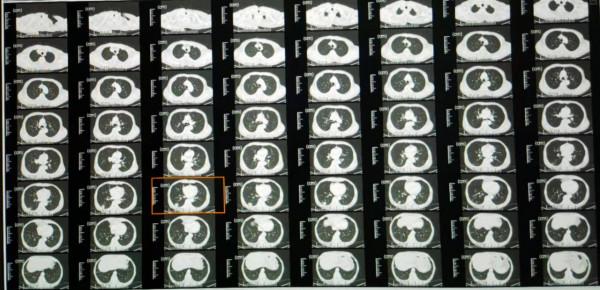 去醫院做了CT 核磁檢查,結果半天出不來,你能理解麼? 去醫院做了CT 核磁檢查,結果半天出不來,你能理解麼?
