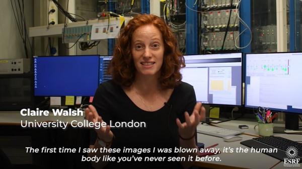 他們用人類史上最強的X光，告訴我們新冠患者的肺傷成了什麼樣