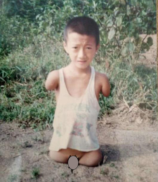 筷子哥:生下來就是一個大肉球,沒有四肢,我也能養活我的妻兒 筷子哥:生下來就是一個大肉球,沒有四肢,我也能養活我的妻兒