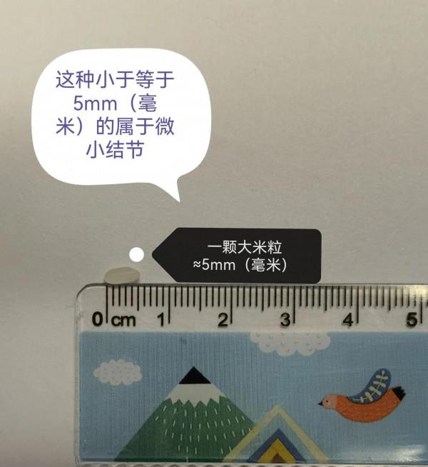 肺結節，“結友”們所關心的&quot;大小&quot;實物對照圖