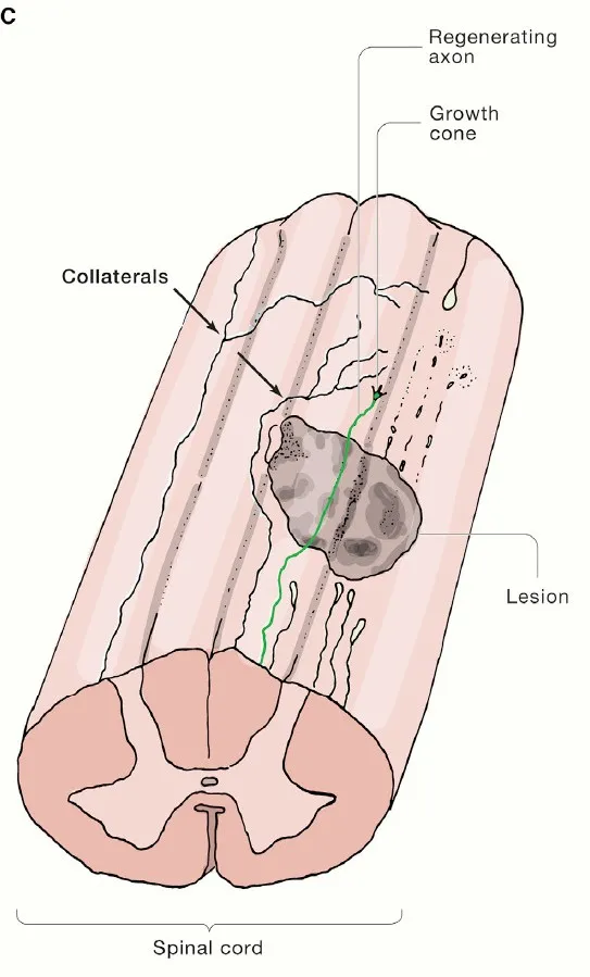 《細胞》綜述:促進中樞神經系統再生,哪些策略有望挺進臨床? 《細胞》綜述:促進中樞神經系統再生,哪些策略有望挺進臨床?