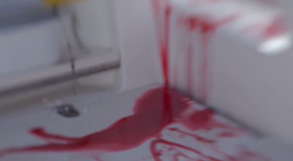 人類被鯊魚襲擊的生死瞬間：硬生生被撕扯掉右臂，看完不敢下海了