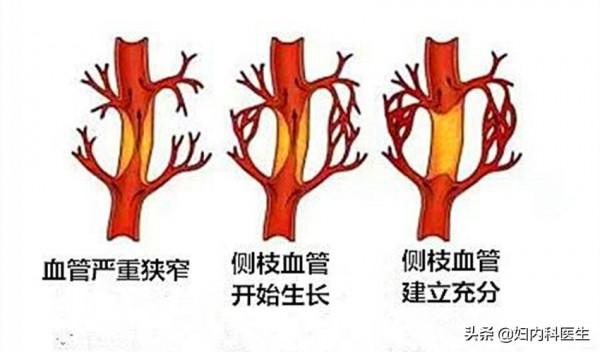 很少生病的人為什麼一生就是大病？醫生告訴你真相