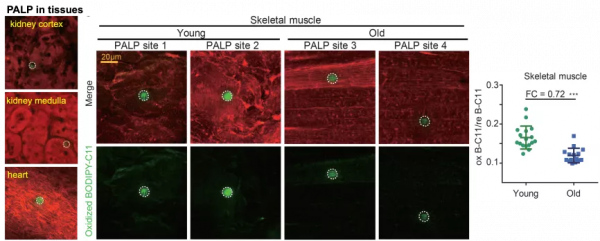 西湖大學學者研發鐵死亡新技術，實現鐵死亡藥物的個體化高效治療