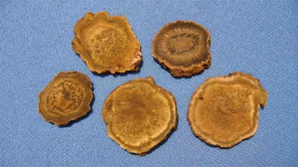 乙肝患者切勿服用這些中藥，這些藥物最傷肝