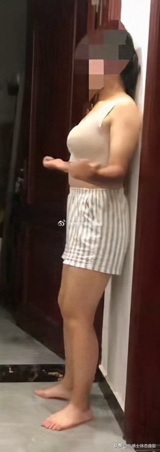 「案例分析」如果自覺體態不正、重心不穩，可能出現了胸廓偏移