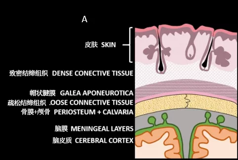 頭皮和顱骨病變的影像學特點 頭皮和顱骨病變的影像學特點