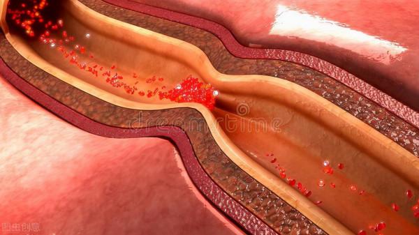 冠心病、心絞痛,吃些什麼藥好呢? 冠心病、心絞痛,吃些什麼藥好呢?