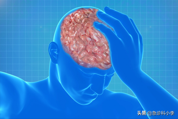 腦梗來臨，睡覺先知？提醒：睡覺出現3個異常，或是腦梗“預警”