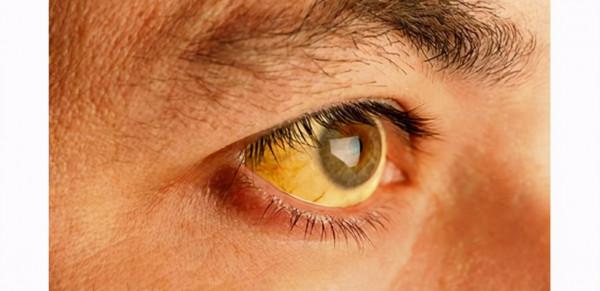 出現這些症狀，小心胰腺炎“找上門”，家裡有人喝酒的要注意