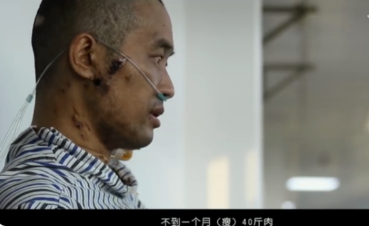 第一批新冠倖存者的故事，空氣都成了奢侈品，短期內暴瘦40斤