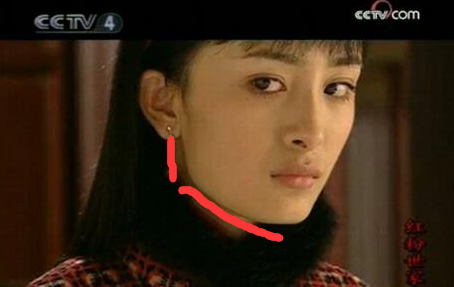 那些一刀切削骨的明星還好嗎?後遺症一大堆,小方臉成最大贏家 那些一刀切削骨的明星還好嗎?後遺症一大堆,小方臉成最大贏家