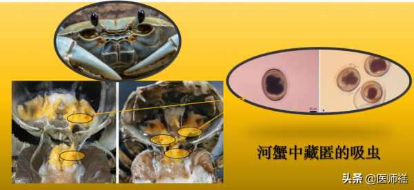 醉蟹吃過嗎?如果你食用的是這種醉蟹,醫生提醒最好去醫院檢查下 醉蟹吃過嗎?如果你食用的是這種醉蟹,醫生提醒最好去醫院檢查下