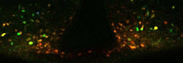 「突破」肥胖問題如何才能有效解決？科學家發現一種安全可行的新方法