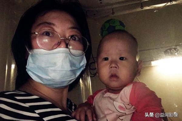 5月大女嬰長紅疹被查出血癌，為安撫孩子打針，媽媽抱了一年多