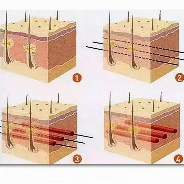抗衰老應該吃什麼?塗什麼?做什麼?答案都在這了 抗衰老應該吃什麼?塗什麼?做什麼?答案都在這了