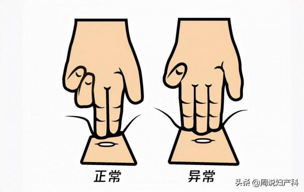 不胖卻有小肚子，當心這3個問題