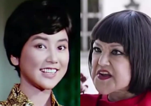 臉腫，嘴歪，笑不出來，整容後的&quot&semi;矽膠臉&quot&semi;把這9位好演員，害慘了