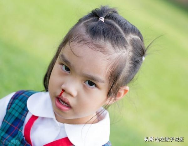 小兒流鼻血花費將近千元,卻查不出病因?是否存在濫開檢查? 小兒流鼻血花費將近千元,卻查不出病因?是否存在濫開檢查?