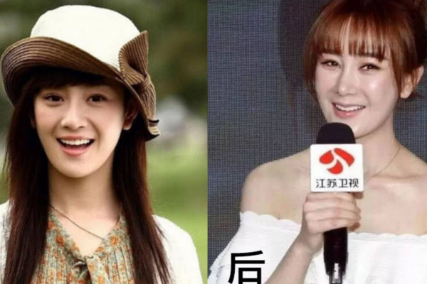 臉僵如石、腫成發麵饅頭，這7位女星動臉後變“災難現場”