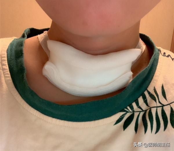 甲狀腺全切後，身體會發生怎樣的變化？哪些情況需要切除甲狀腺？