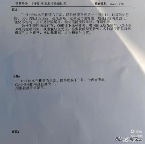 30歲女子右下肢麻木,多次治療無效,被細心老專家查出原因 30歲女子右下肢麻木,多次治療無效,被細心老專家查出原因