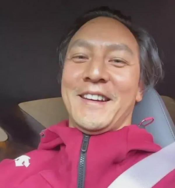 在脫髮面前，明星不比普通人好到哪兒去