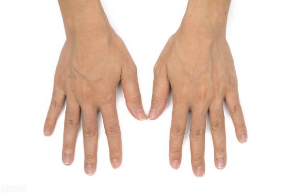 “青筋凸起”是因血管毒素淤積？小心這些部位的凸起，或是疾病