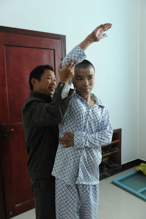 11年前,那個探親中途浴火救44人,全身90%燒傷的子弟兵,現況如何