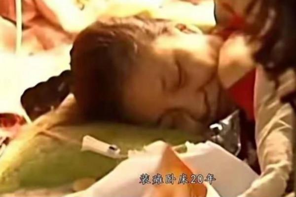 因母親過度溺愛，35歲女兒假裝癱瘓20年，最後竟“弄假成真”