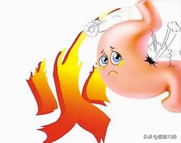 容易上火是什麼原因，是陰虛火旺體質嗎？怎麼調理比較好？