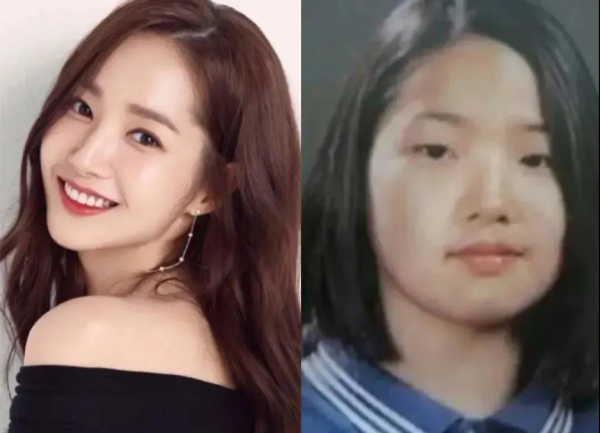 明明擁有媽生美貌，卻變成&OpenCurlyDoubleQuote;整容怪物&rdquo;？她們何苦啊