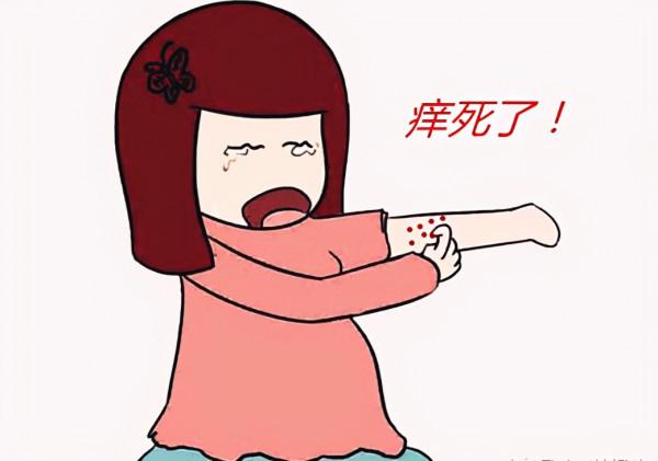 蕁麻疹癢的難受?一劑消風散,消風清熱,除溼止癢,有效解除風團 蕁麻疹癢的難受?一劑消風散,消風清熱,除溼止癢,有效解除風團