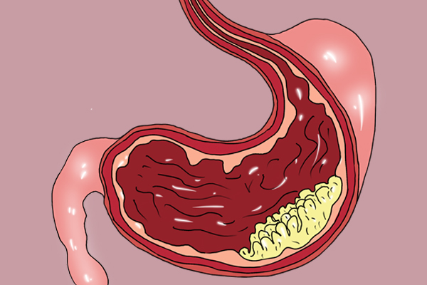 為啥癌症更“青睞”男性?可能是3點做得不如女人,怎麼改? 為啥癌症更“青睞”男性?可能是3點做得不如女人,怎麼改?