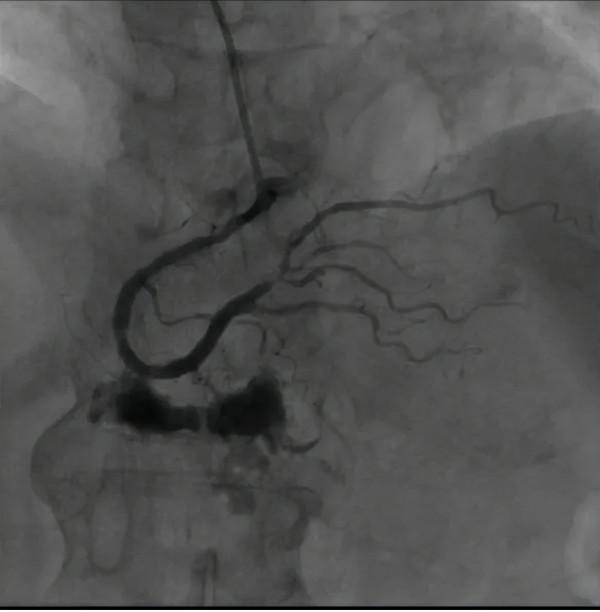 精準評估,多學科診療護佑老年患者健康 精準評估,多學科診療護佑老年患者健康