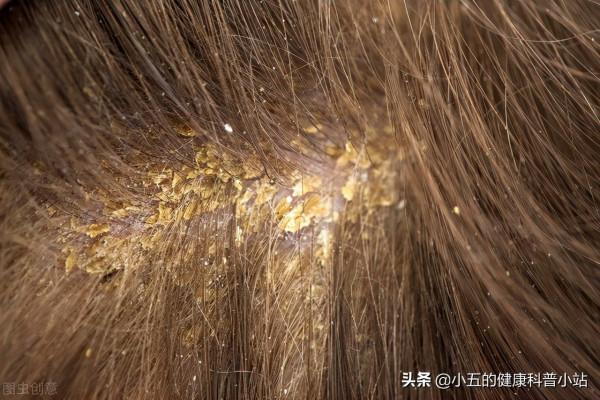 便宜的谷維素是治療失眠、高血脂的良藥,服用時注意4個問題 便宜的谷維素是治療失眠、高血脂的良藥,服用時注意4個問題