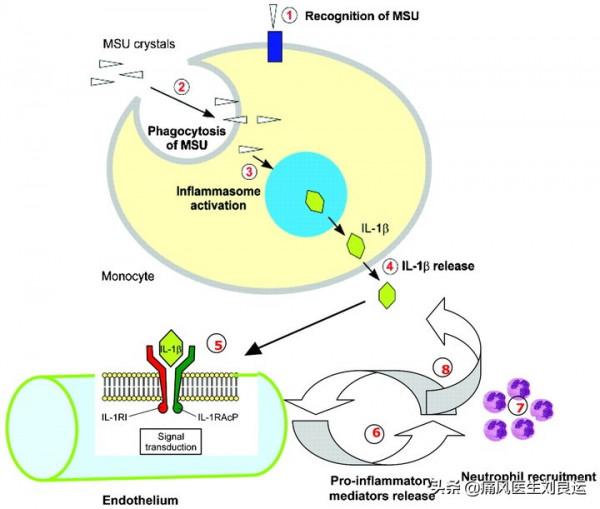 秋水仙鹼可以降尿酸？醫生說，哪怕急性痛風止痛也不一定有用
