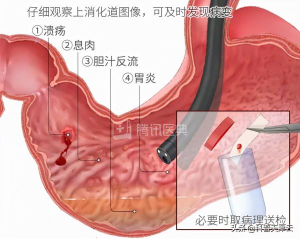 胃不好的人,儘量別吃這種藥!這4類藥才能保護你的胃 胃不好的人,儘量別吃這種藥!這4類藥才能保護你的胃