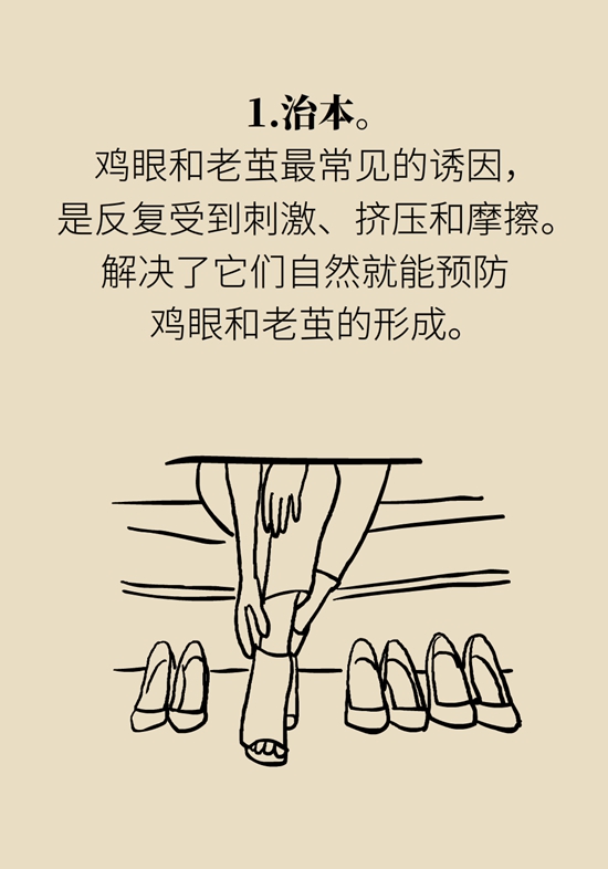 長了雞眼和老繭怎麼辦？這份防治指南請收好