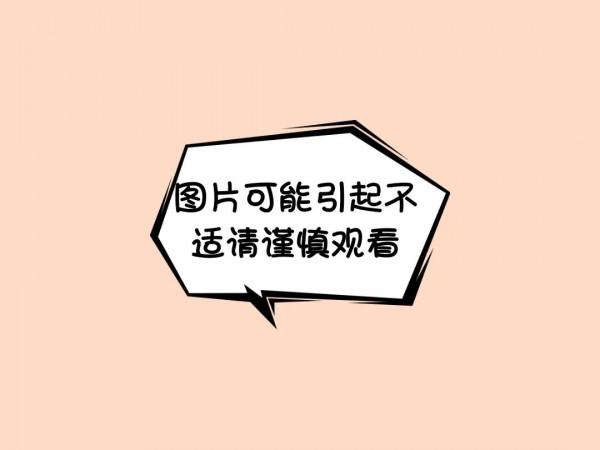 二胎媽媽突發胎盤早剝,多學科展開生死營救 二胎媽媽突發胎盤早剝,多學科展開生死營救