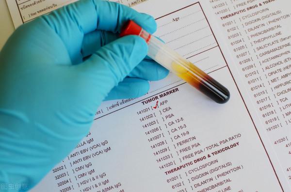 除了腸鏡還有什麼能檢查出腸道腫瘤或者腸癌，貴不貴？疼不疼？