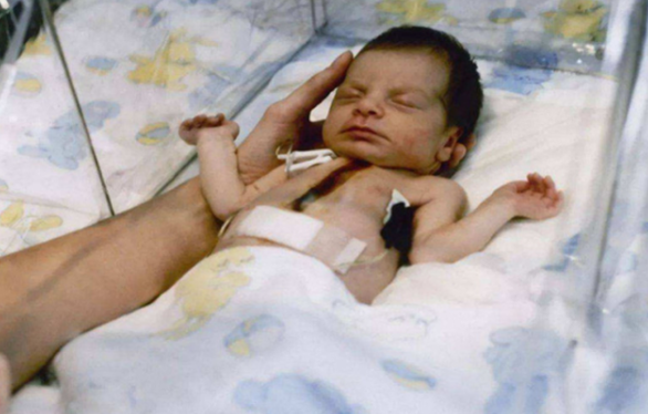 1984年,美國母親為給初生女兒續命,冒險移植狒狒心臟,最後怎樣了? 1984年,美國母親為給初生女兒續命,冒險移植狒狒心臟,最後怎樣了?