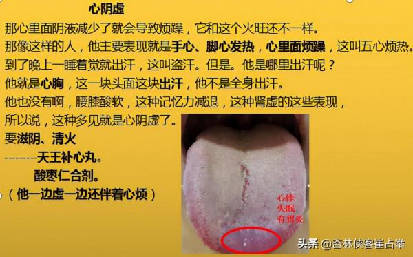 治療失眠的中成藥大總結,失眠、多夢、入睡困難再也不怕用錯藥 治療失眠的中成藥大總結,失眠、多夢、入睡困難再也不怕用錯藥