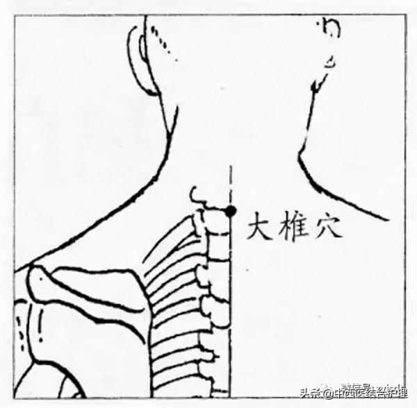 「穴位養生」大椎穴，調病多