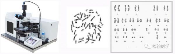 人工智慧+醫學檢驗:中國是否會趕上這一程序? 人工智慧+醫學檢驗:中國是否會趕上這一程序?