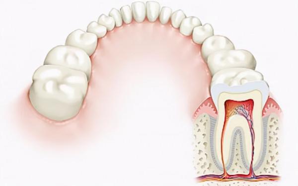 你的牙正在悄悄開裂